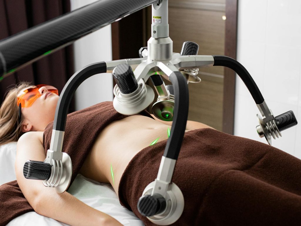 Top 5 Myths About Liposuction Debunked