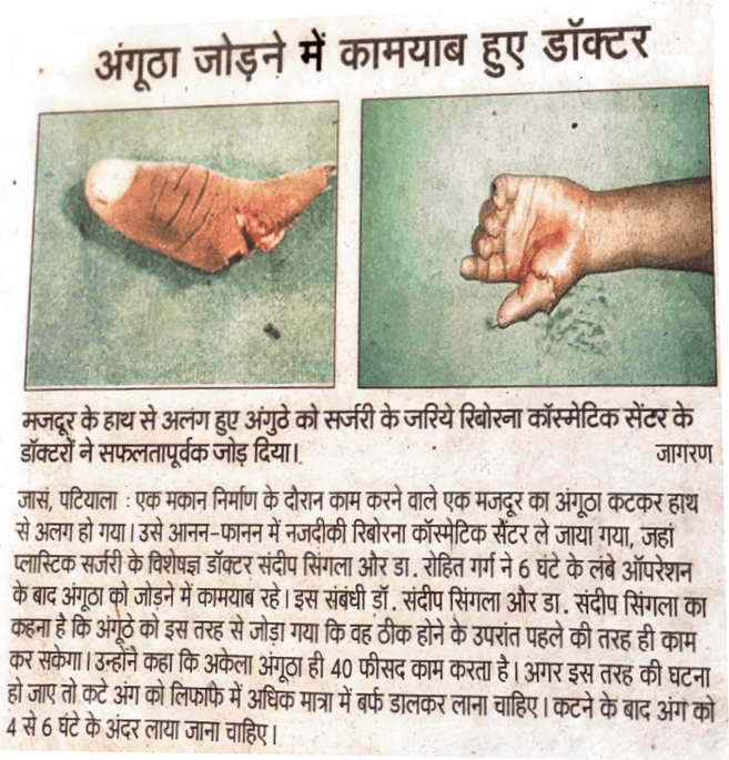 thumb surgery