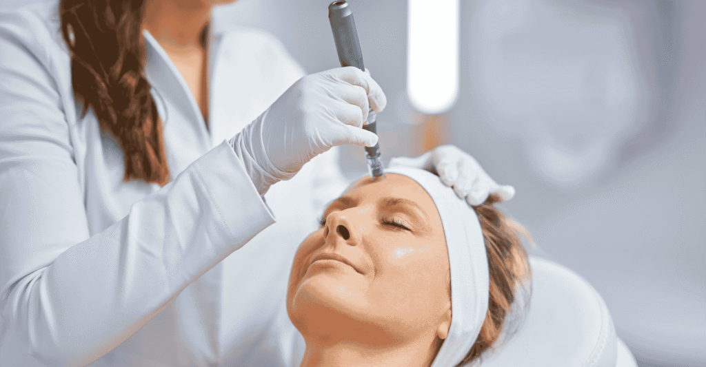 microneedling on an middle aged worman